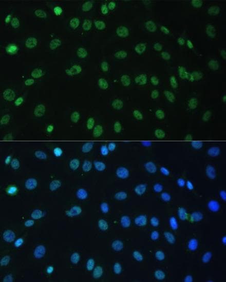HNRNPD / AUF1 Antibody