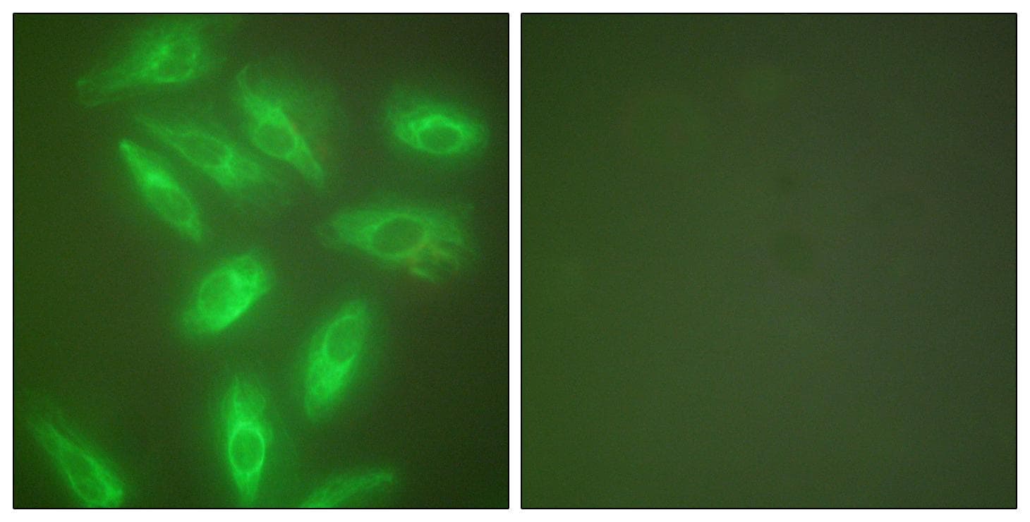 KRT18 / CK18 / Cytokeratin 18 Antibody