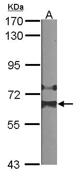 IHC-plus™ Polyclonal Rabbit anti-Human HDAC1 Antibody (IHC, IF, WB)