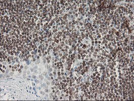 F13A1 / Factor XIIIa Antibody (clone 6F5, Carrier-free)
