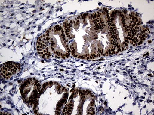 ALOX5 / 5-LOX Antibody (aa18-364, clone OTI1C1)