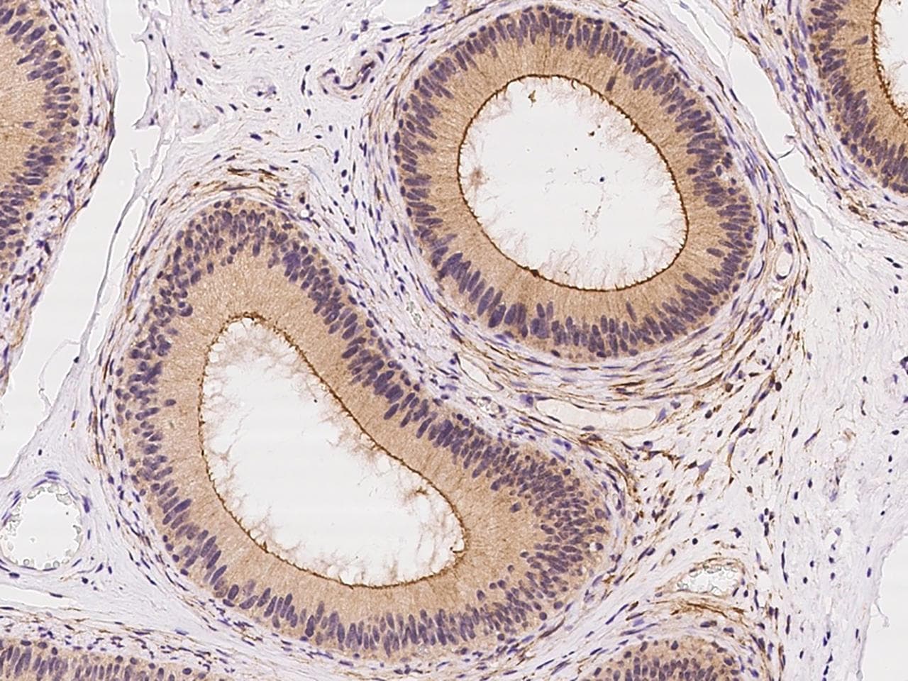 Polyclonal Rabbit anti-Human DLGAP4 Antibody (IHC)