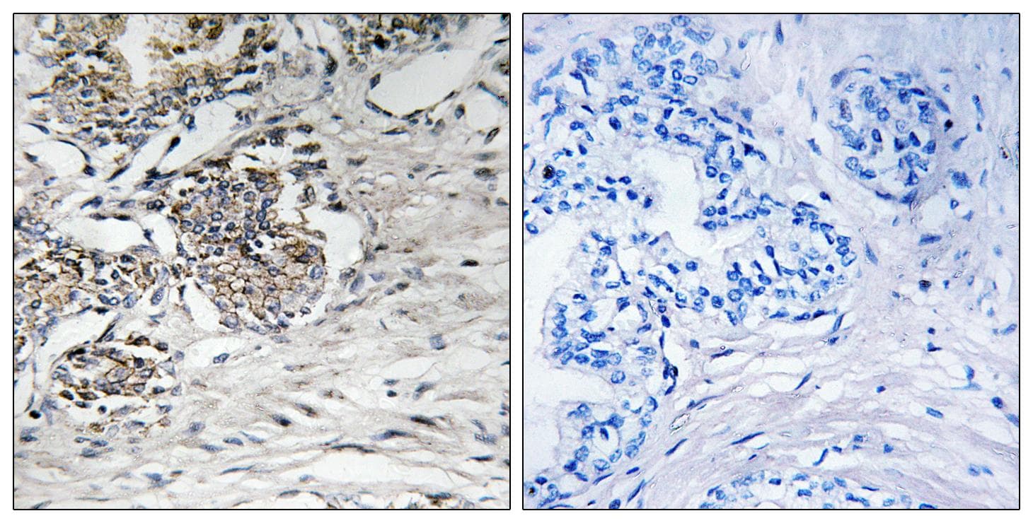CLDN7 / Claudin 7 Antibody (p210)