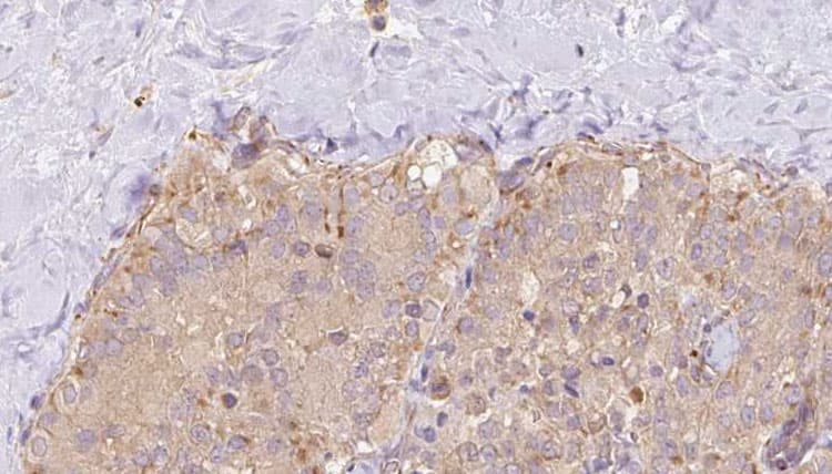 STX17 / Syntaxin 17 Antibody
