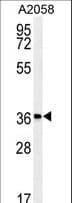 Polyclonal Rabbit anti-Human MFSD3 Antibody (aa174-202, IHC, WB)