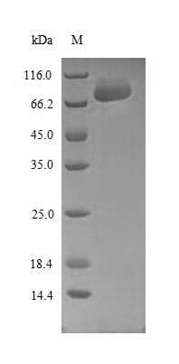 Human SPRED1 Protein (Recombinant 10His-SUMO, N-terminus + Myc, C-terminus)