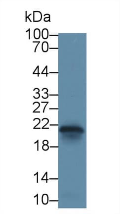 CAV1 / Caveolin 1 Antibody (aa2-105, Cy3)