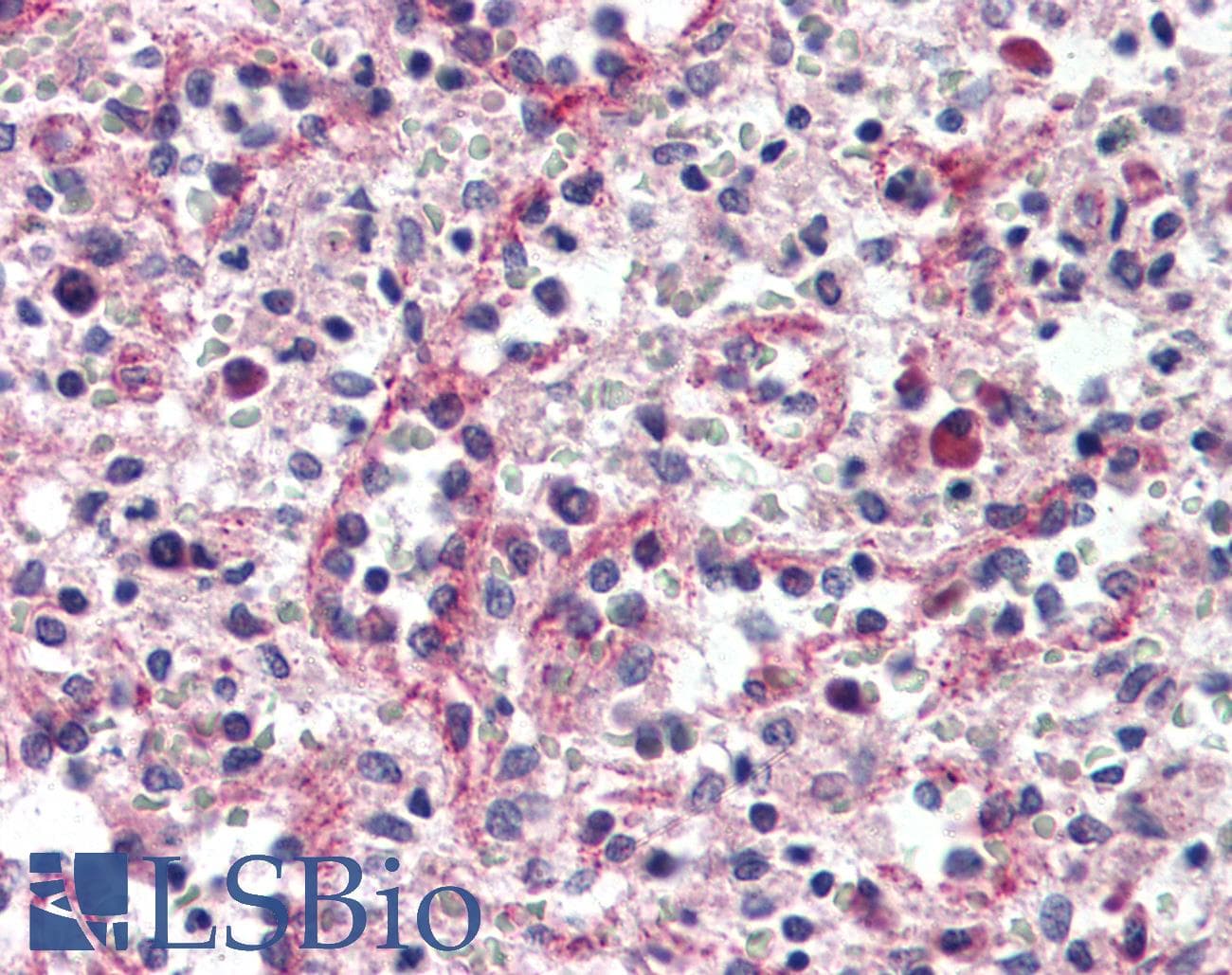 IHC-plus™ CTNND1 / p120 Catenin Antibody (C-Terminus)