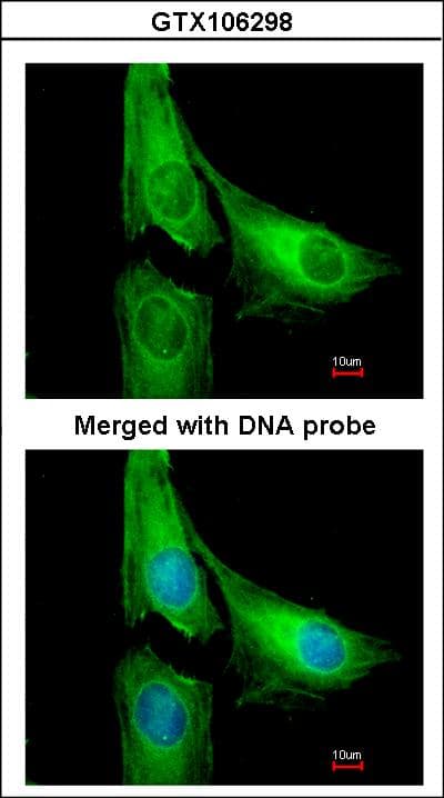 CENTG2 / AGAP1 Antibody (aa795-857)
