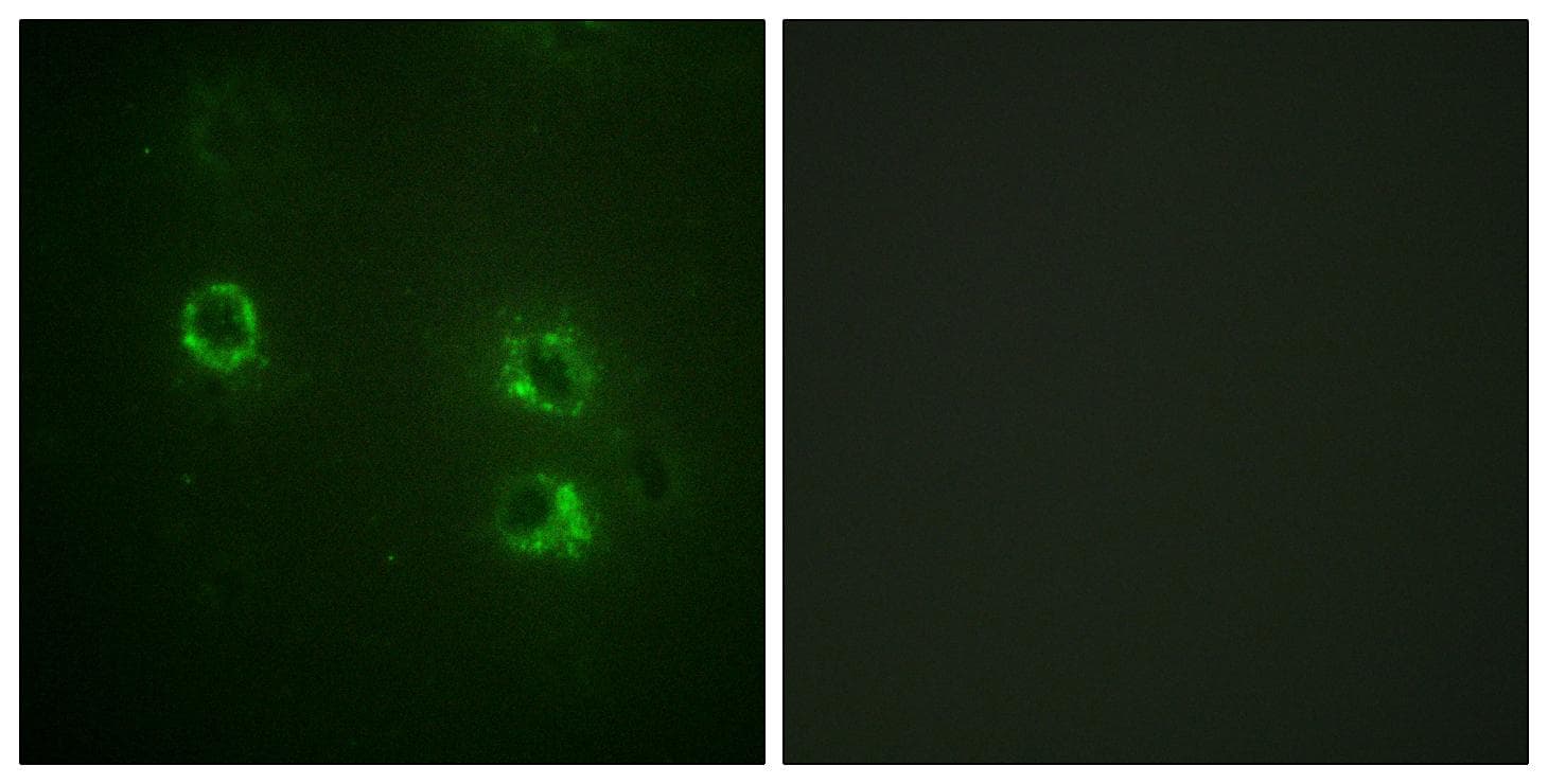 SYN1 / Synapsin 1 Antibody