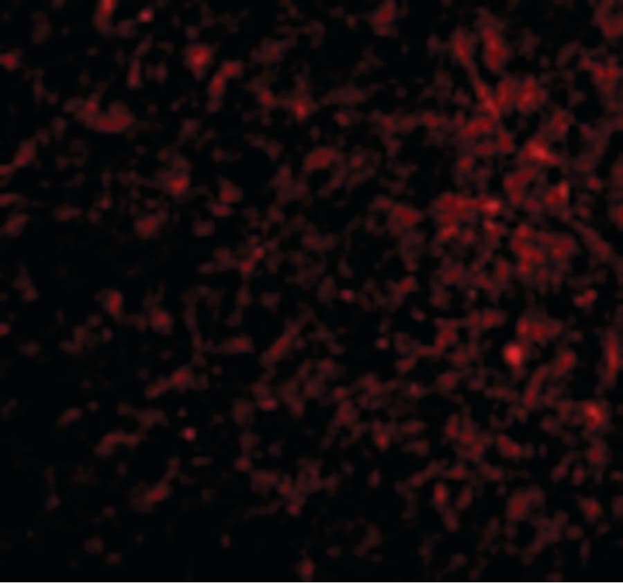 IHC-plus™ NCSTN / Nicastrin Antibody