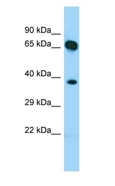 Polyclonal Rabbit anti-Human SHC4 Antibody (aa97-146, WB)