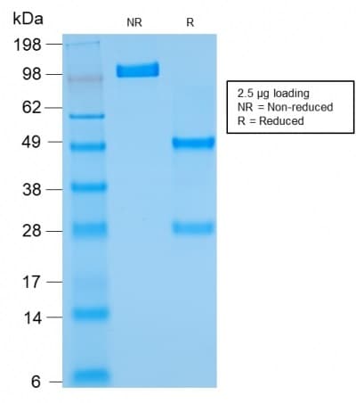 PathPlus™ BCL2 / Bcl-2 Antibody (clone rBCL2/782)