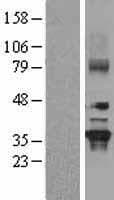 Human GNB2 Protein (Over-Expression Lysate Myc-DDK (Flag))