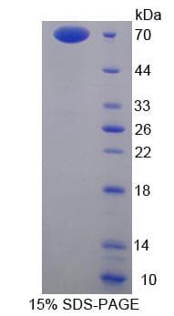Human ANXA9 Protein (Recombinant His-GST)
