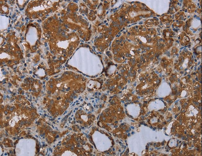 Polyclonal Rabbit anti-Human MEIS1 Antibody (IHC)