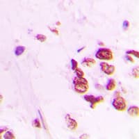 PAX8 Antibody (Internal)