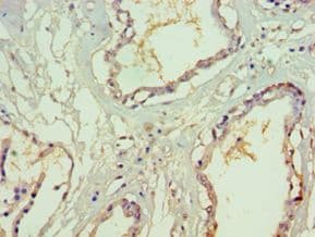 SF3B130 / SF3B3 Antibody (aa948-1217)