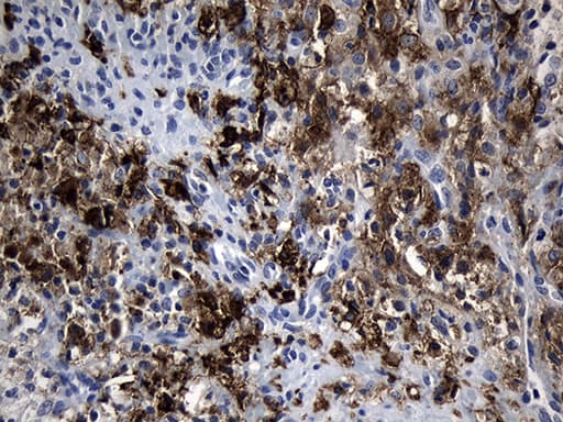 CLEC4M / L-SIGN / CD299 Antibody (aa74-329, clone OTI10C3)