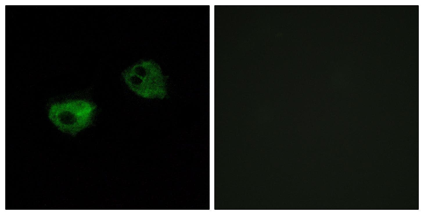 MTNR1A / Melatonin Receptor 1a Antibody