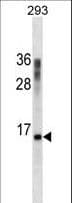 IHC-plus™ CST3 / Cystatin C Antibody (aa95-122)