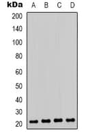CBX3 / HP1 Gamma Antibody (phospho-Ser93)