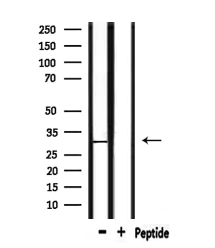 Polyclonal Rabbit anti-Human CD151 Antibody (IHC, IF, WB)