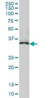 Monoclonal Mouse anti-Human MAPRE2 / EB2 Antibody (clone 4D7, IF, WB)