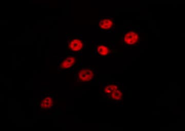 Polyclonal Rabbit anti-Human MED8 Antibody (IF, WB)