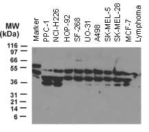 NOD2 / CARD15 Antibody (aa582-600)