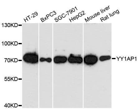Polyclonal Rabbit anti-Human YY1AP1 Antibody (WB)