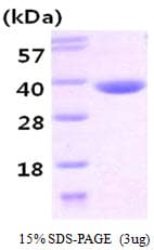 Human CBR3 Protein (Recombinant His)