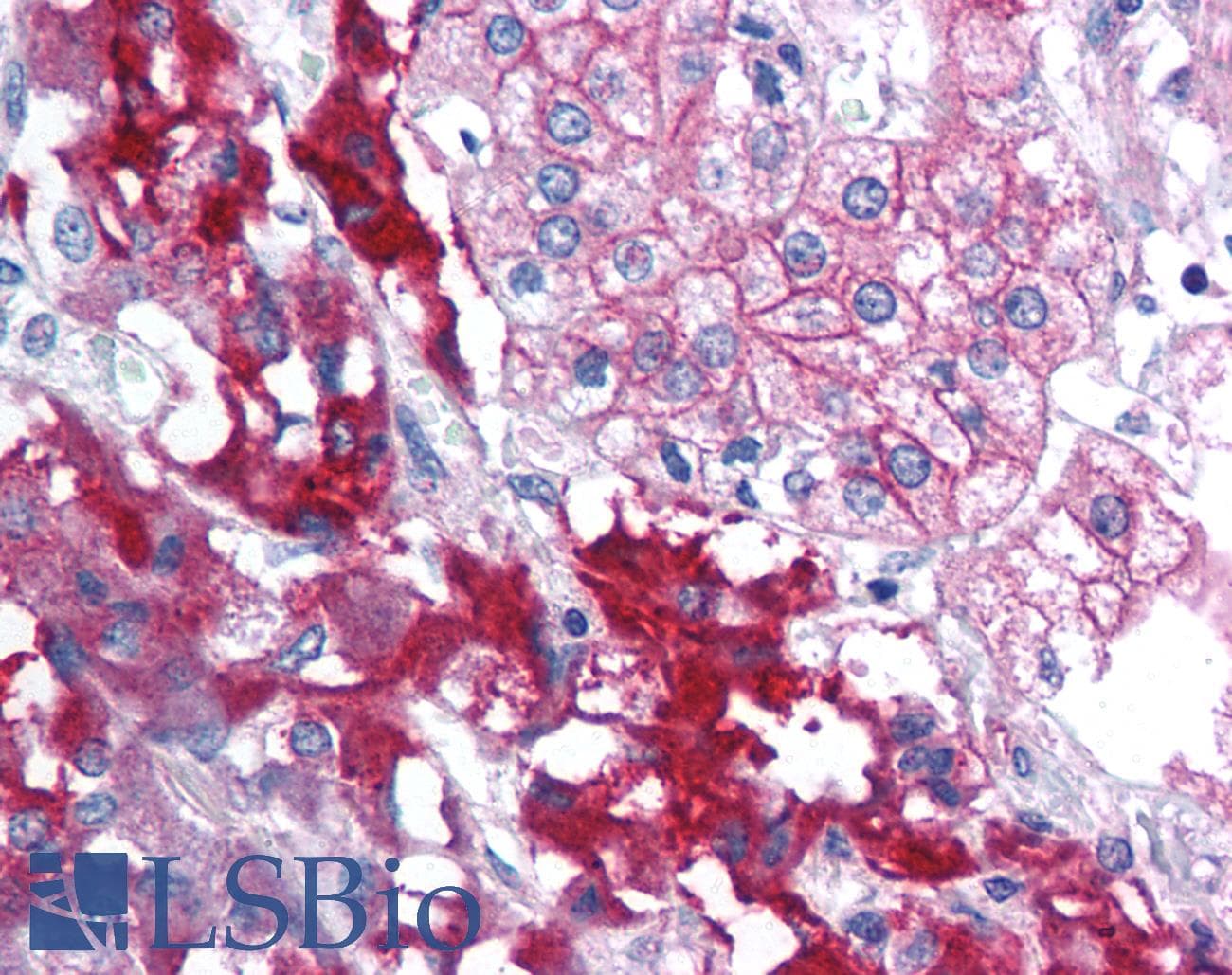 IHC-plus™ RPAIN Antibody