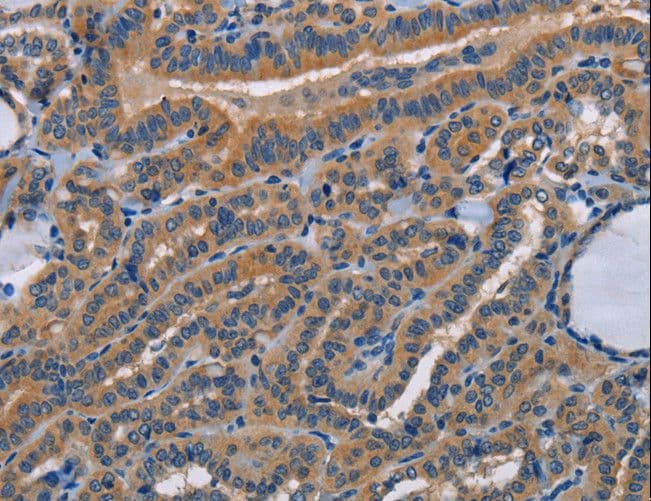 STRADB / ALS2CR2 Antibody
