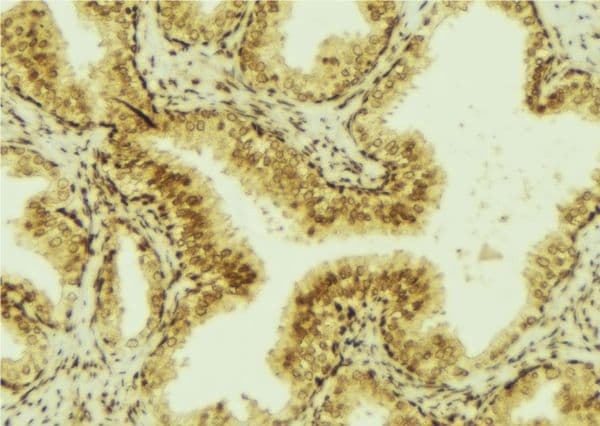 TFF3 / Trefoil Factor 3 Antibody