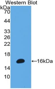 MPO / Myeloperoxidase Antibody (aa165-278)