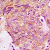 GRB14 Antibody (Internal)