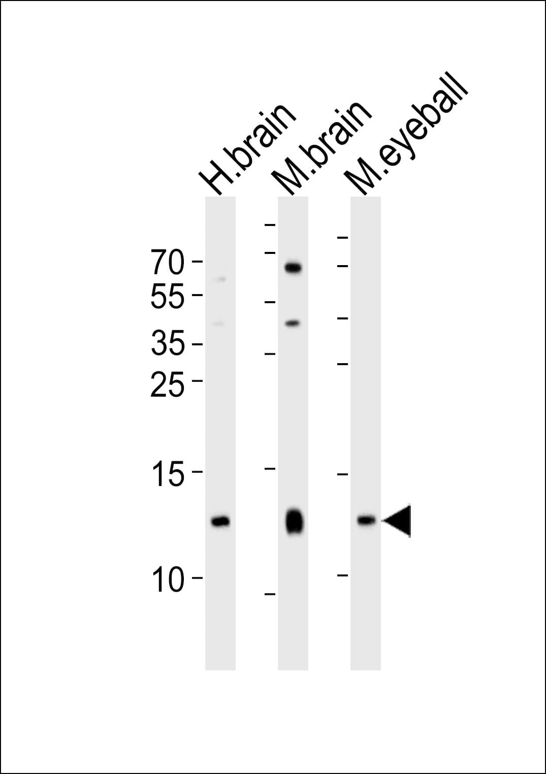 Polyclonal Rabbit anti-Human HBG2 / Hemoglobin Gamma 2 Antibody (aa101-133, WB)