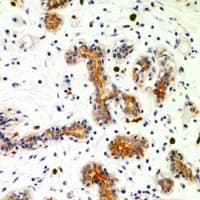 DNM1L / DRP1 Antibody