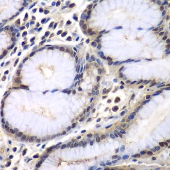 Polyclonal Rabbit anti-Human PSMB2 Antibody (IHC, IF, WB)