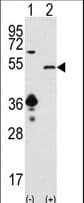 IHC-plus™ Polyclonal Rabbit anti-Human SIRT7 / Sirtuin 7 Antibody (aa331-360, IHC, WB)