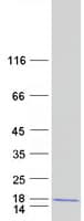 Human ADIG / Adipogenin Protein (Recombinant Myc-DDK (Flag))