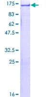 Human USP4 Protein (Recombinant GST)