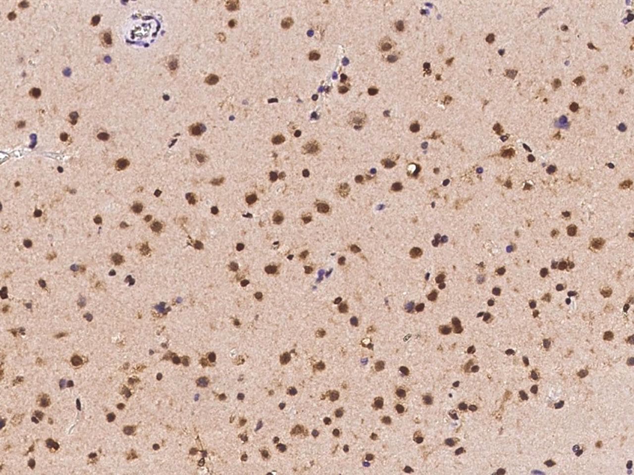 ZNF782 Antibody