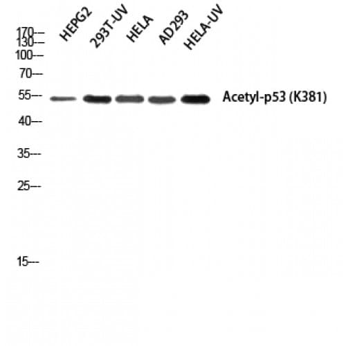 Polyclonal Rabbit anti-Human TP53 / p53 Antibody (320-400 aa, IHC, IF, WB)