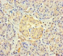 KIAA1467 Antibody