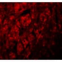 IHC-plus™ LRRTM3 Antibody
