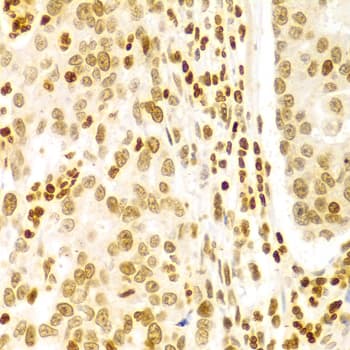 Polyclonal Rabbit anti-Human DKC1 / Dyskerin Antibody (IHC, IF, WB)