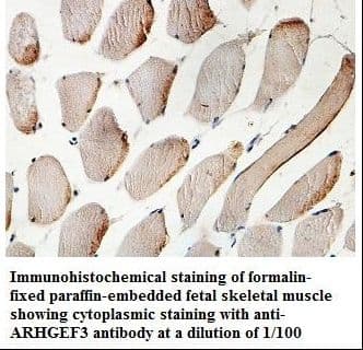 Polyclonal Rabbit anti-Human ARHGEF3 / XPLN Antibody (aa3-194, IHC, WB)