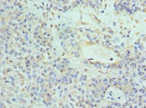 NTRK3 / TRKC Antibody (aa40-300)